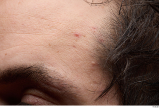 HD Face Skin Dash eye face forehead hair skin pores…